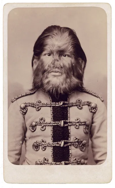 Jo-Jo The Dog-Faced Boy